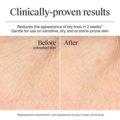 PureHydra™ Moisture Cream